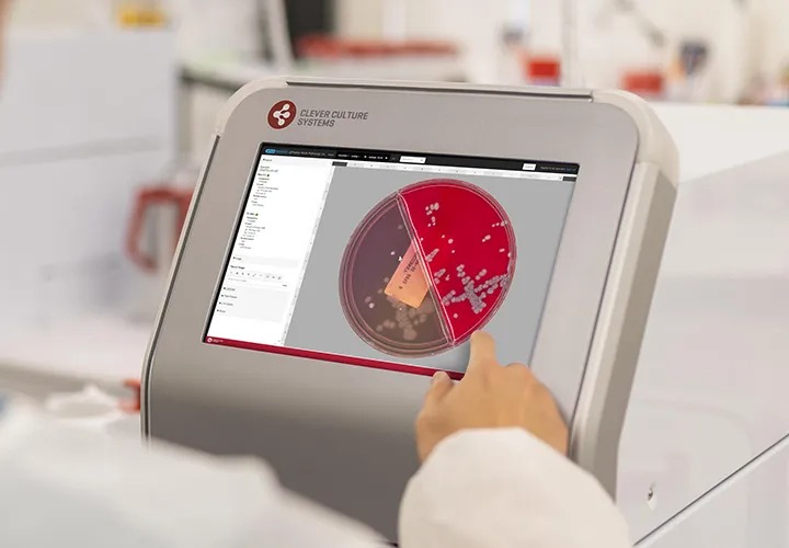 clever culture systems